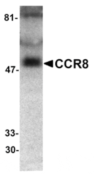 Western blot - CCR8 Antibody from Signalway Antibody (24057) - Antibodies.com