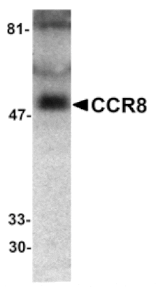 Western blot - CCR8 Antibody from Signalway Antibody (24057) - Antibodies.com