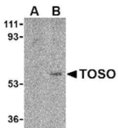 Western blot - Toso Antibody from Signalway Antibody (24107) - Antibodies.com