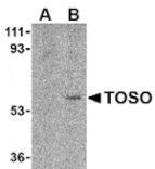Western blot - Toso Antibody from Signalway Antibody (24107) - Antibodies.com