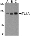 Western blot - TL1A Antibody from Signalway Antibody (24187) - Antibodies.com