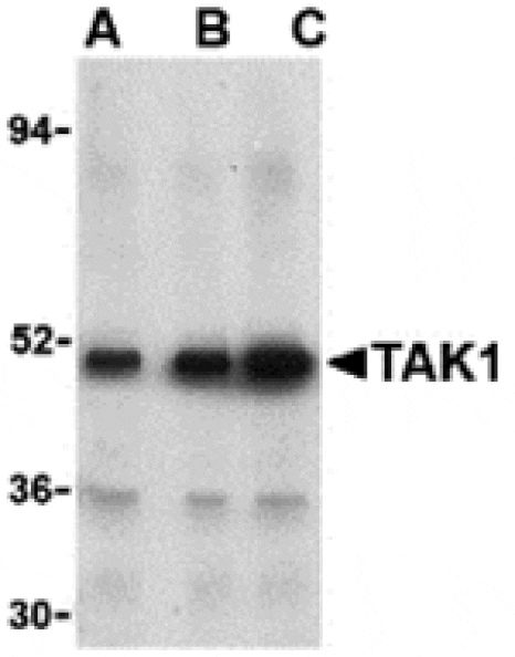 Western blot - TAK1 Antibody from Signalway Antibody (24261) - Antibodies.com
