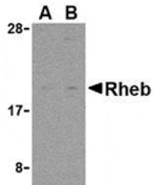Western blot - Rheb Antibody from Signalway Antibody (24306) - Antibodies.com