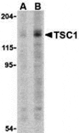 Western blot - TSC1 Antibody from Signalway Antibody (24308) - Antibodies.com