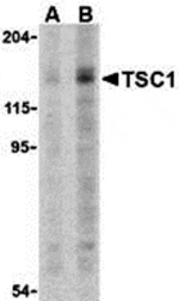 Western blot - TSC1 Antibody from Signalway Antibody (24308) - Antibodies.com