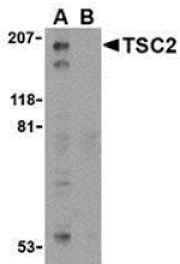 Western blot - TSC2 Antibody from Signalway Antibody (24310) - Antibodies.com