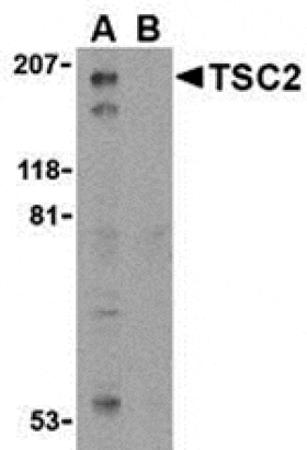 Western blot - TSC2 Antibody from Signalway Antibody (24310) - Antibodies.com