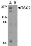 Western blot - TSC2 Antibody from Signalway Antibody (24310) - Antibodies.com