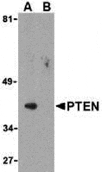 Western blot - PTEN Antibody from Signalway Antibody (24314) - Antibodies.com