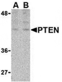 Western blot - PTEN Antibody from Signalway Antibody (24315) - Antibodies.com