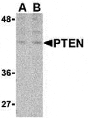 Western blot - PTEN Antibody from Signalway Antibody (24315) - Antibodies.com