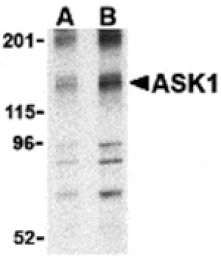 Western blot - ASK1 Antibody from Signalway Antibody (24381) - Antibodies.com
