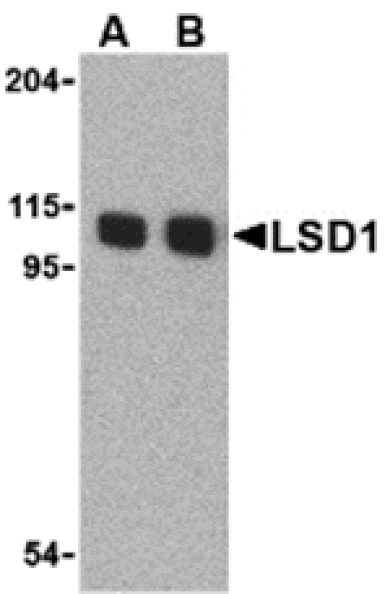 Western blot - LSD1 Antibody from Signalway Antibody (24397) - Antibodies.com