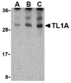 Western blot - TL1A Antibody from Signalway Antibody (24408) - Antibodies.com