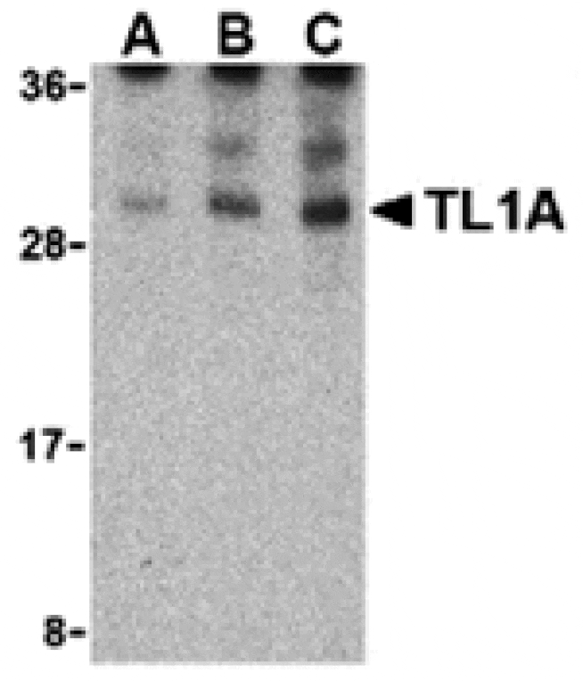Western blot - TL1A Antibody from Signalway Antibody (24408) - Antibodies.com