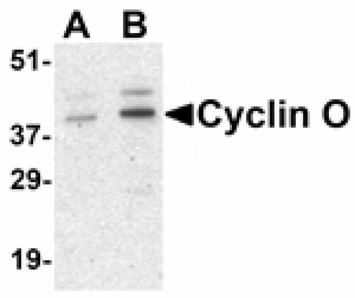 Western blot - UNG2 Antibody from Signalway Antibody (24430) - Antibodies.com