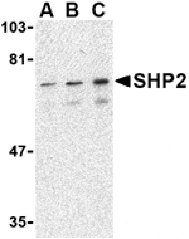 Western blot - SHP2 Antibody from Signalway Antibody (24446) - Antibodies.com