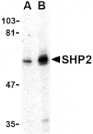 Western blot - SHP2 Antibody from Signalway Antibody (24447) - Antibodies.com