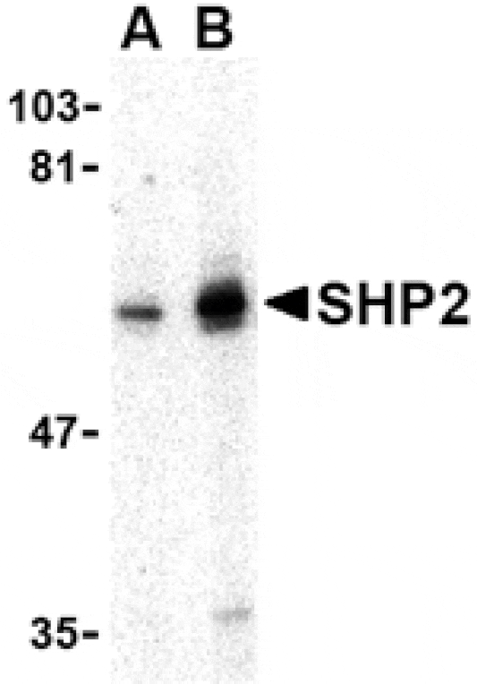 Western blot - SHP2 Antibody from Signalway Antibody (24447) - Antibodies.com