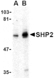 Western blot - SHP2 Antibody from Signalway Antibody (24447) - Antibodies.com