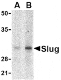 Western blot - Slug Antibody from Signalway Antibody (24462) - Antibodies.com