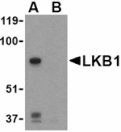 Western blot - LKB1 Antibody from Signalway Antibody (24473) - Antibodies.com