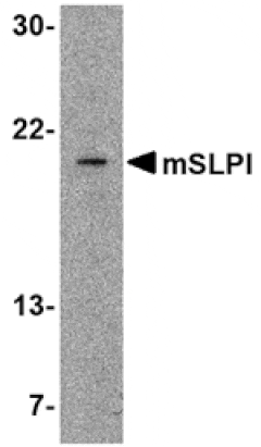 Western blot - SLPI Antibody from Signalway Antibody (24543) - Antibodies.com