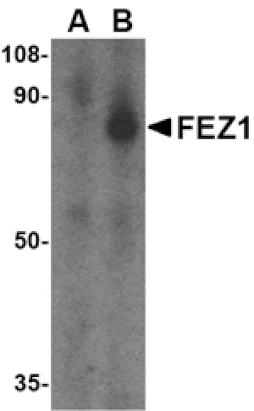 Western blot - FEZ1 Antibody from Signalway Antibody (24547) - Antibodies.com