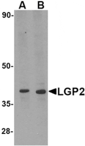Western blot - LGP2 Antibody from Signalway Antibody (24587) - Antibodies.com