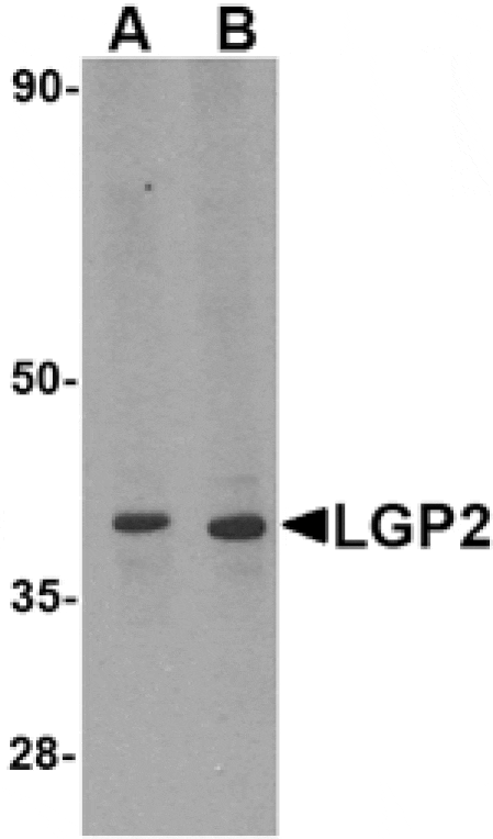 Western blot - LGP2 Antibody from Signalway Antibody (24587) - Antibodies.com