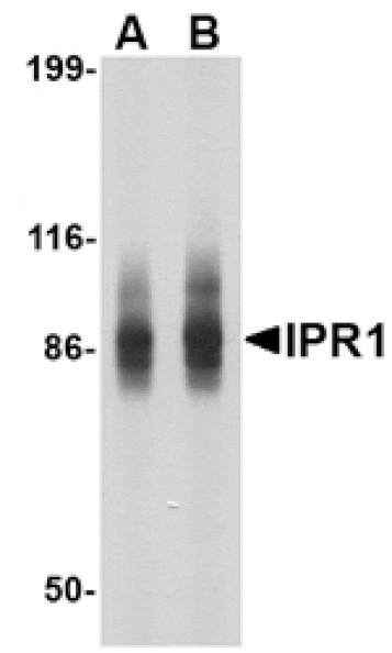 Western blot - IPR1 Antibody from Signalway Antibody (24612) - Antibodies.com