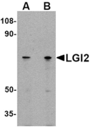 Western blot - LGI2 Antibody from Signalway Antibody (24643) - Antibodies.com