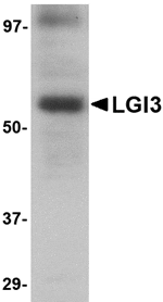 Western blot analysis of LGI3 in human brain tissue lysate with LGI3 antibody at 1 µg/mL.