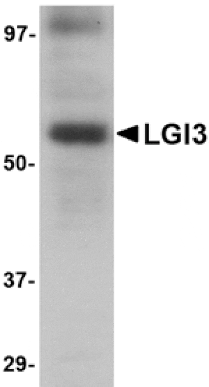 Western blot - LGI3 Antibody from Signalway Antibody (24644) - Antibodies.com