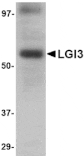 Western blot - LGI3 Antibody from Signalway Antibody (24644) - Antibodies.com