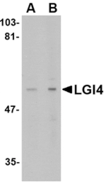 Western blot - LGI4 Antibody from Signalway Antibody (24650) - Antibodies.com