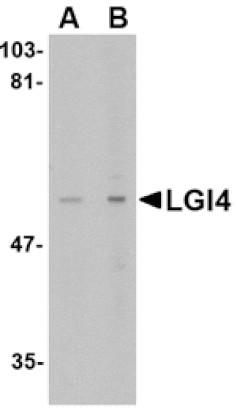 Western blot - LGI4 Antibody from Signalway Antibody (24650) - Antibodies.com