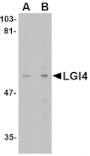 Western blot - LGI4 Antibody from Signalway Antibody (24650) - Antibodies.com
