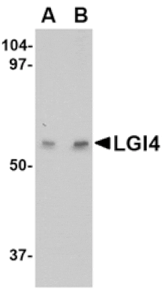 Western blot - LGI4 Antibody from Signalway Antibody (24651) - Antibodies.com