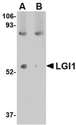 Western blot analysis of LGI1 in mouse brain tissue lysate with LGI1 antibody at 1 µg/mL in (A) the absence and (B) the presence of blocking peptide.