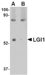 Western blot - LGI1 Antibody from Signalway Antibody (24654) - Antibodies.com