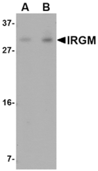 Western blot - IRGM Antibody from Signalway Antibody (24660) - Antibodies.com