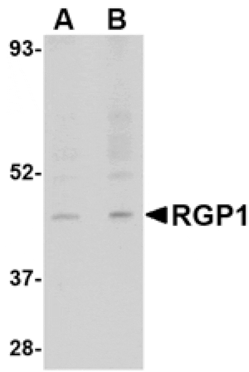 Western blot - RGP1 Antibody from Signalway Antibody (24671) - Antibodies.com