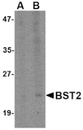 Western blot - Bst2 Antibody from Signalway Antibody (24709) - Antibodies.com