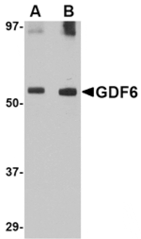 Western blot - GDF6 Antibody from Signalway Antibody (24717) - Antibodies.com