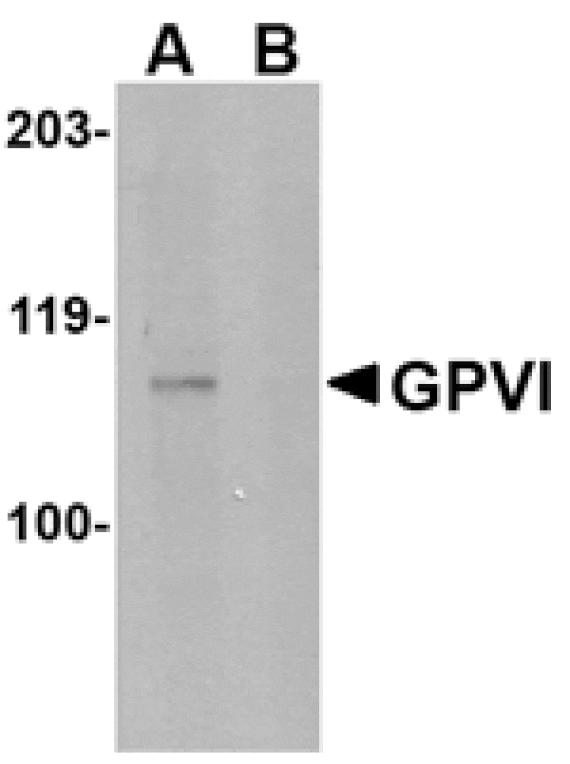 Western blot - GPVI Antibody from Signalway Antibody (24743) - Antibodies.com