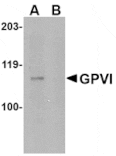 Western blot - GPVI Antibody from Signalway Antibody (24743) - Antibodies.com