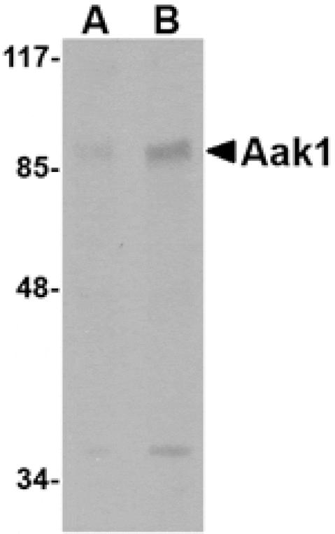 Western blot - Aak1 Antibody from Signalway Antibody (24767) - Antibodies.com