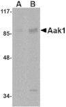 Western blot - Aak1 Antibody from Signalway Antibody (24767) - Antibodies.com