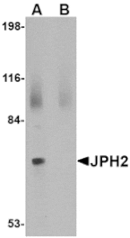 Western blot - JPH2 Antibody from Signalway Antibody (24794) - Antibodies.com